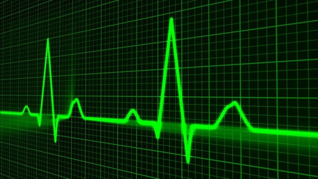 cholesterol lipids strong heart